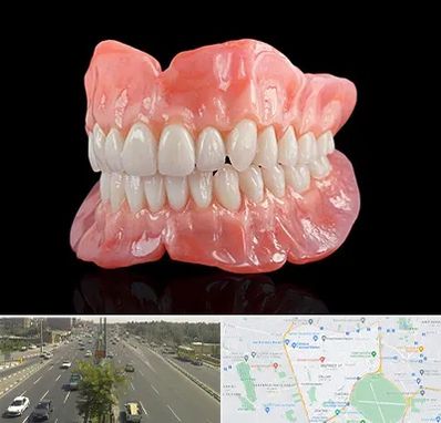ساخت دندان مصنوعی در منطقه 17 تهران 