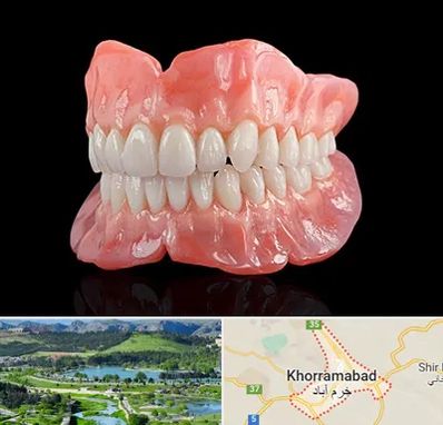ساخت دندان مصنوعی در خرم آباد