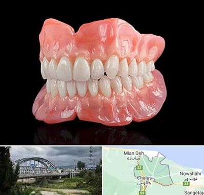 ساخت دندان مصنوعی در چالوس