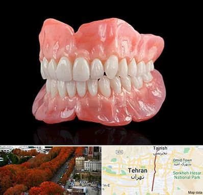 ساخت دندان مصنوعی در ولیعصر 