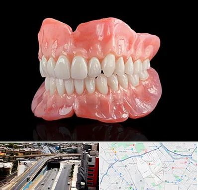 ساخت دندان مصنوعی در ستارخان شیراز 
