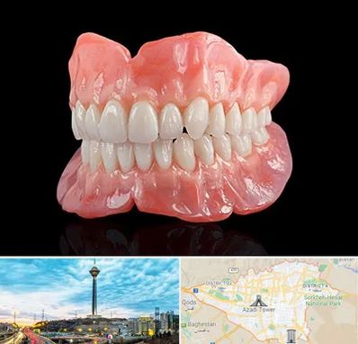 ساخت دندان مصنوعی در تهران