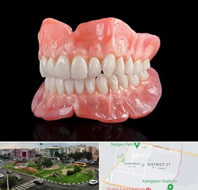 ساخت دندان مصنوعی در تهرانسر 