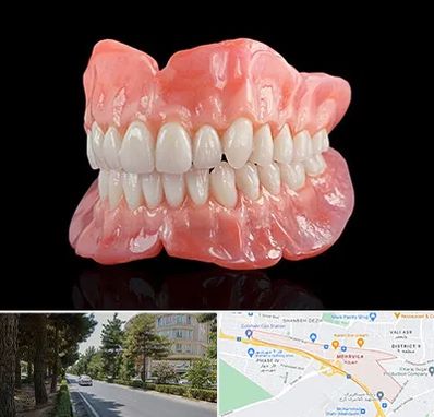 ساخت دندان مصنوعی در مهرویلا کرج 