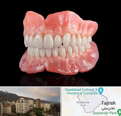 ساخت دندان مصنوعی در زعفرانیه 