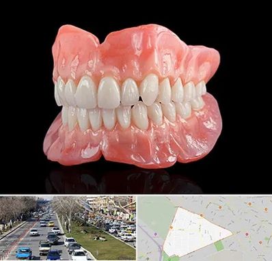 ساخت دندان مصنوعی در احمدآباد مشهد 