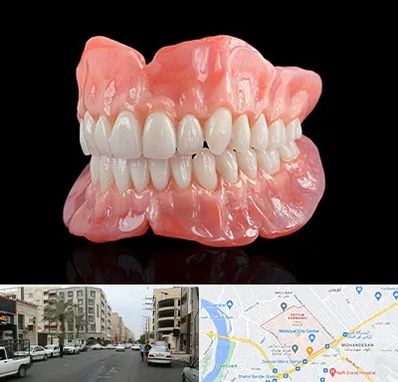 ساخت دندان مصنوعی در زیتون کارمندی اهواز 