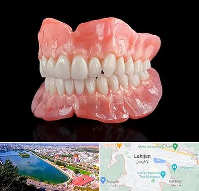 ساخت دندان مصنوعی در لاهیجان