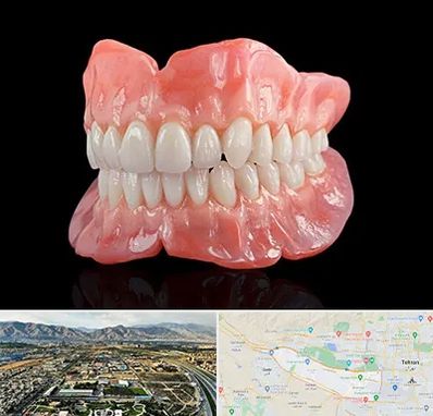 ساخت دندان مصنوعی در منطقه 21 تهران 