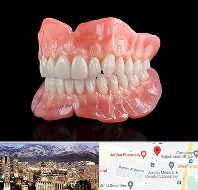 ساخت دندان مصنوعی در جردن 