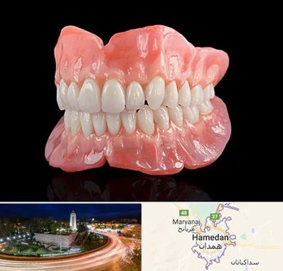 ساخت دندان مصنوعی در همدان