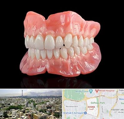 ساخت دندان مصنوعی در گیشا 