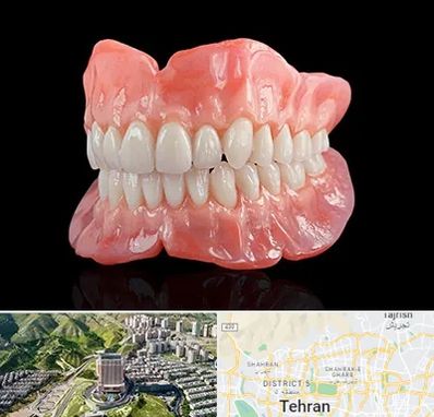 ساخت دندان مصنوعی در شمال تهران 