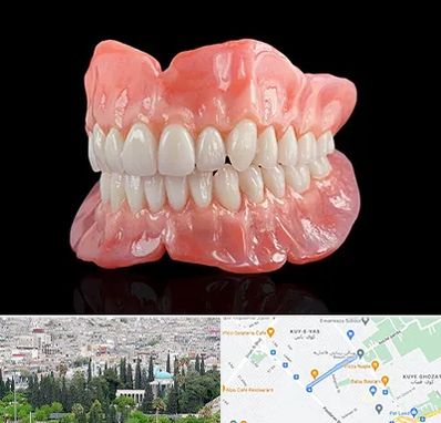 ساخت دندان مصنوعی در محلاتی شیراز