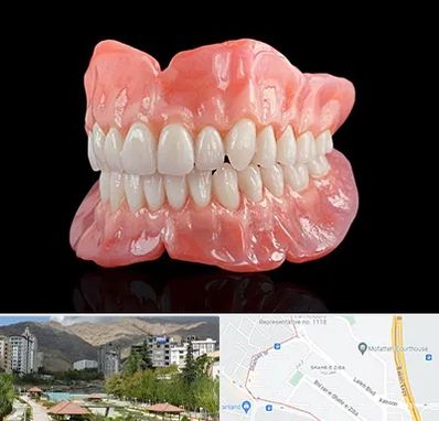 ساخت دندان مصنوعی در شهر زیبا 