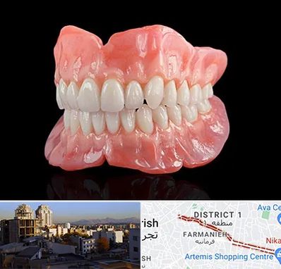 ساخت دندان مصنوعی در فرمانیه 