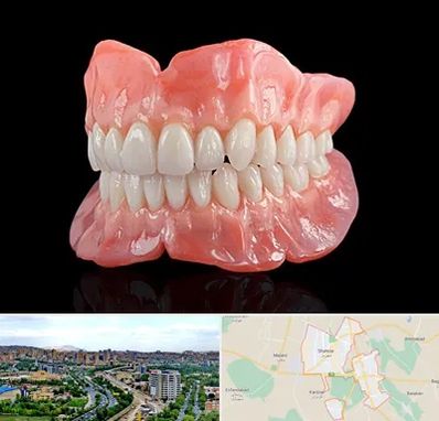 ساخت دندان مصنوعی در شهریار
