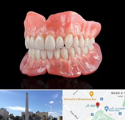 ساخت دندان مصنوعی در فلکه گاز شیراز