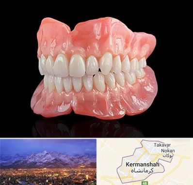 ساخت دندان مصنوعی در کرمانشاه