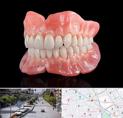 ساخت دندان مصنوعی در خیابان زند شیراز 