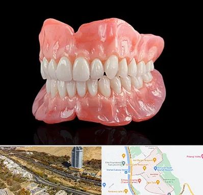 ساخت دندان مصنوعی در خیابان نیایش شیراز 