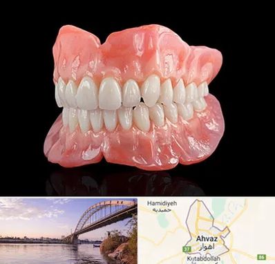 ساخت دندان مصنوعی در اهواز