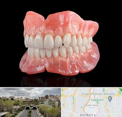 ساخت دندان مصنوعی در یوسف آباد 