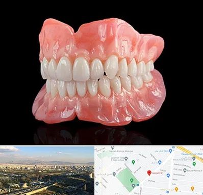 ساخت دندان مصنوعی در هنگام 
