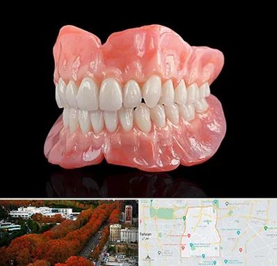 ساخت دندان مصنوعی در منطقه 6 تهران 