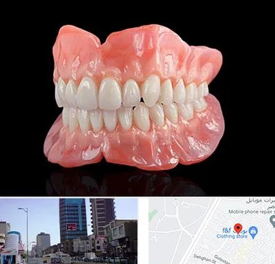 ساخت دندان مصنوعی در چهارراه طالقانی کرج 