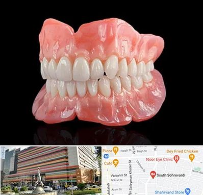 ساخت دندان مصنوعی در سهروردی 