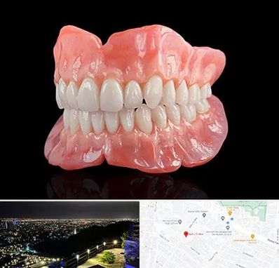ساخت دندان مصنوعی در هفت تیر مشهد 