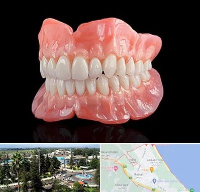 ساخت دندان مصنوعی در رودسر