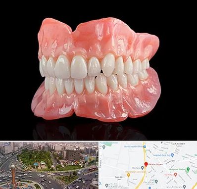 ساخت دندان مصنوعی در سبلان 
