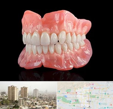 ساخت دندان مصنوعی در منطقه 5 تهران 