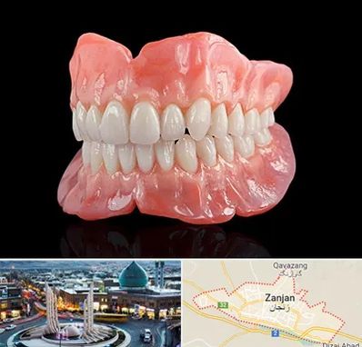 ساخت دندان مصنوعی در زنجان
