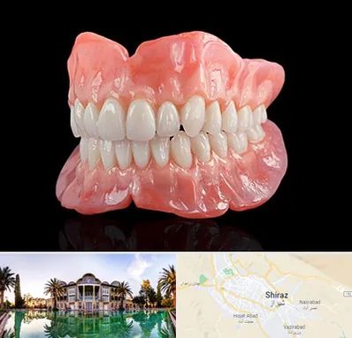 ساخت دندان مصنوعی در شیراز