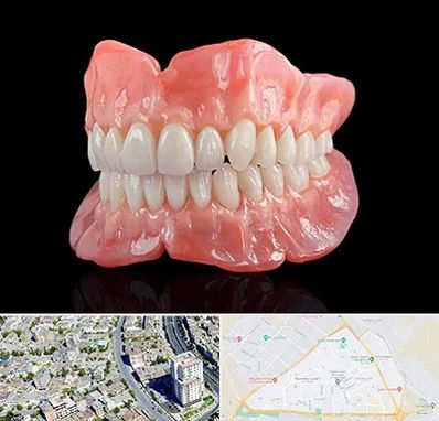 ساخت دندان مصنوعی در قاسم آباد مشهد 