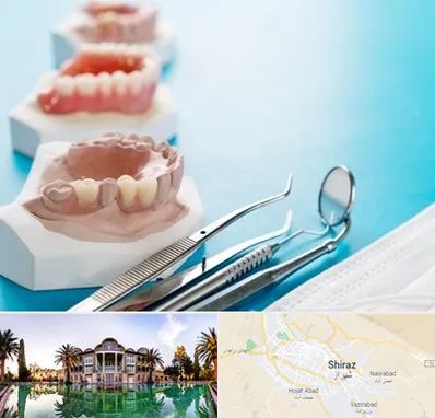 متخصص روکش دندان در شیراز