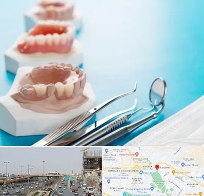 متخصص روکش دندان در بلوار توس مشهد 