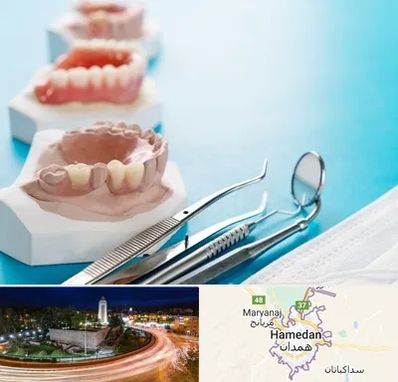 متخصص روکش دندان در همدان