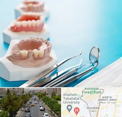متخصص روکش دندان در شهران 