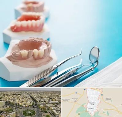 متخصص روکش دندان در قزوین