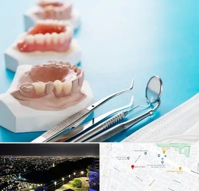 متخصص روکش دندان در هفت تیر مشهد 