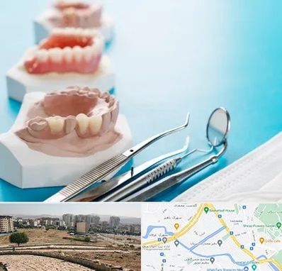 متخصص روکش دندان در کوی وحدت شیراز