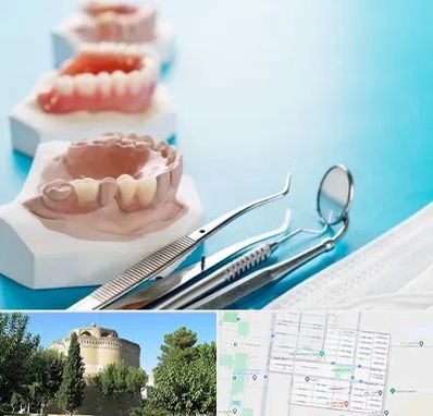 متخصص روکش دندان در مرداویج اصفهان 