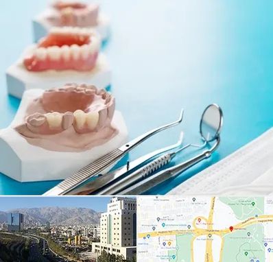 متخصص روکش دندان در حقانی 