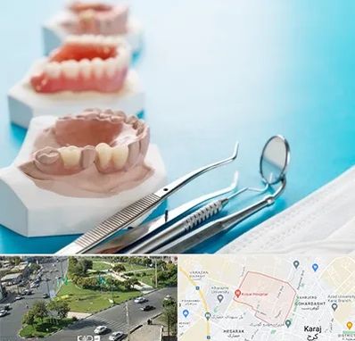 متخصص روکش دندان در شاهین ویلا کرج 