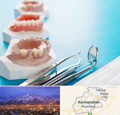 متخصص روکش دندان در کرمانشاه