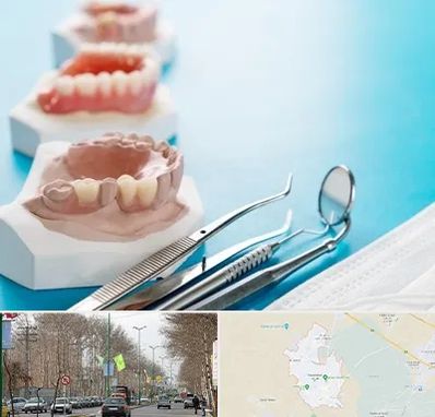 متخصص روکش دندان در نظرآباد کرج 
